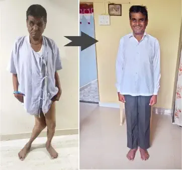 case of month 3