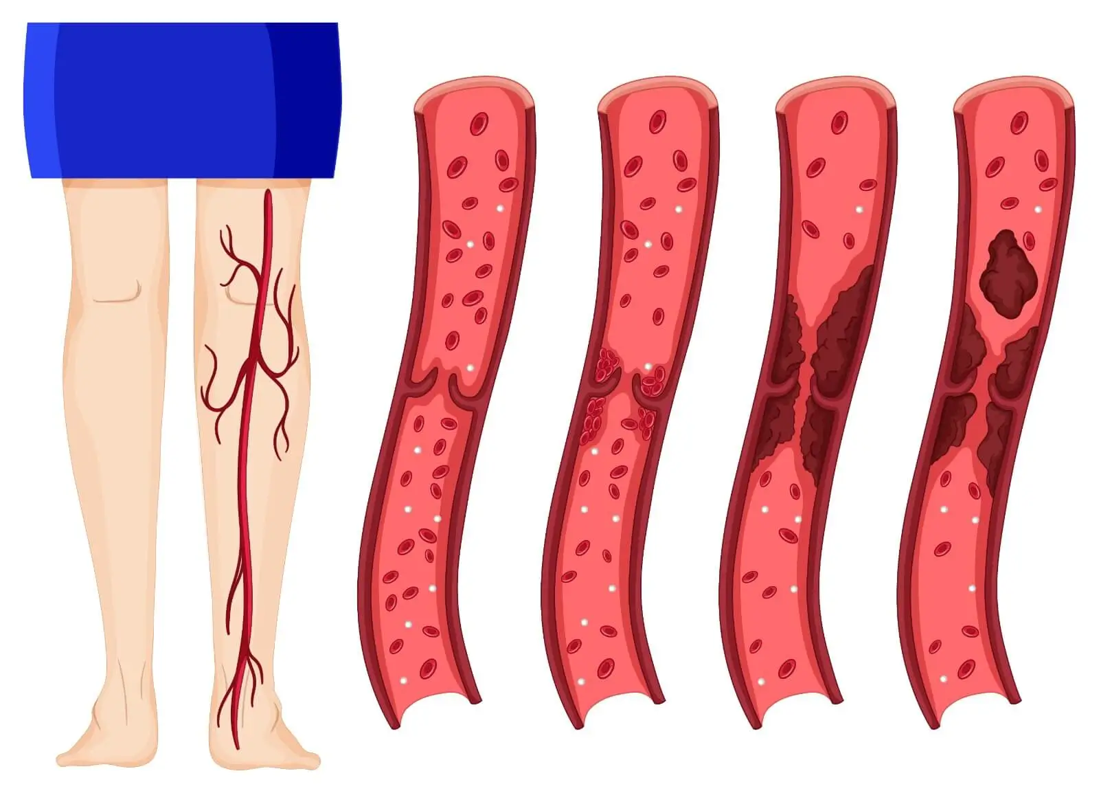 Vascular Surgery