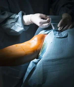 Arthroscopy & Sports Medicine