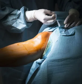 Arthroscopy & Sports Medicine