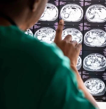 Neurosurgery